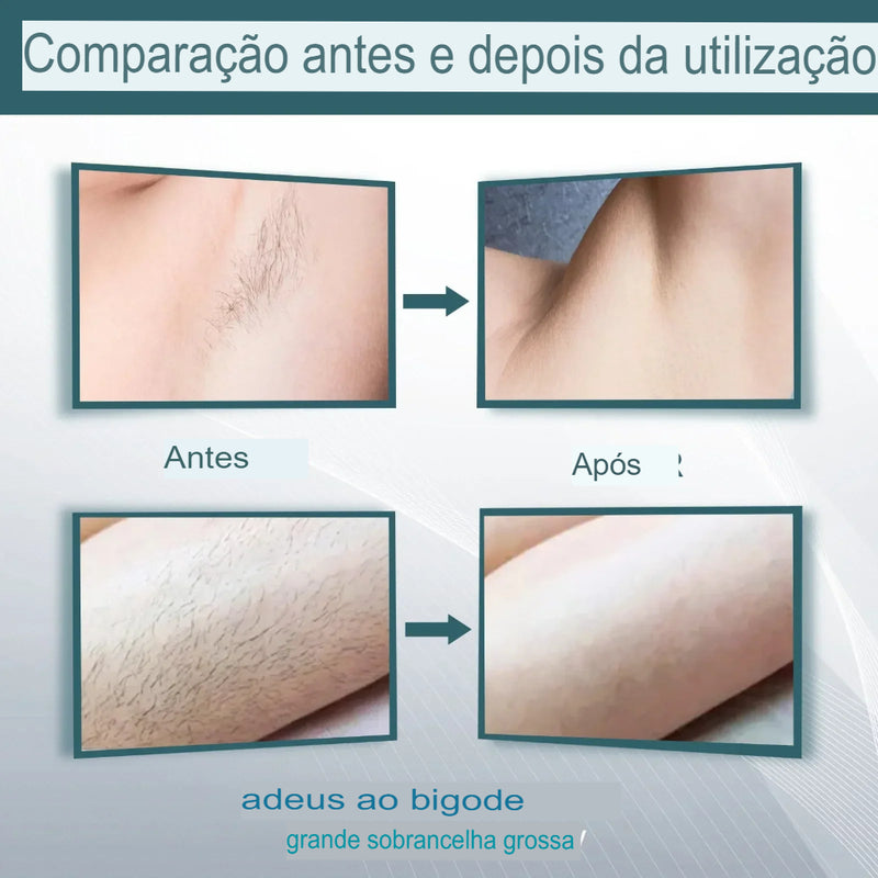 Creme Depilatório Permanente Depilador Creme Áreas Íntimas Saúde Removedor de Pelos Indolor Inibidor de Crescimento para Mulheres Homens Cuidados com o Corpo